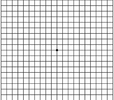 Tørr AMD (netthinnesykdommer): Amsler-kort-testen